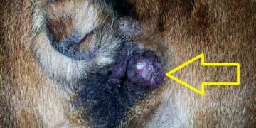 Vulva Tümörleri Nedir?