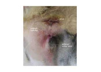 Vulva Yapışıklığı Nedir?