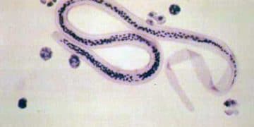 Vuşereriozis Nedir?