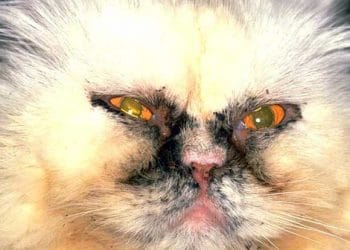 Waardenburg-Klein Sendromu Nedir?