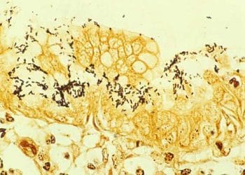 Warthin-Starry Gümüş Boyası Nedir?