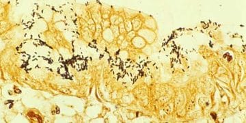 Warthin-Starry Gümüş Boyası Nedir?