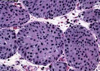 Von Brunn Yuvaları Nedir?