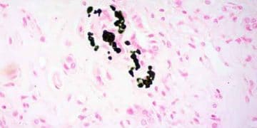 Von Kossa Boyama Yöntemi Nedir?