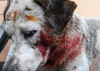 Von Willebrand Hastalığı Nedir?