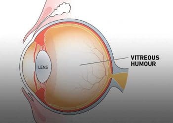 Vitreus Hümor Nedir?