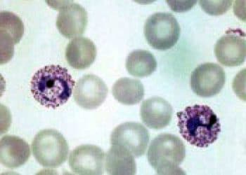 Vivaks Malarya Nedir?