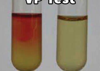 Voges Proskauer Nedir?