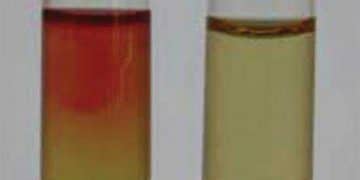 Voges Proskauer Nedir?