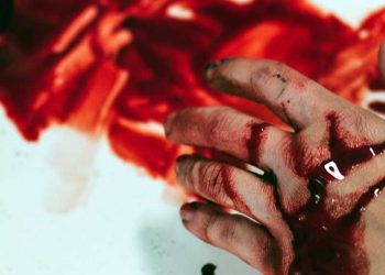 Kanamanın İlaçlarla Durdurulması