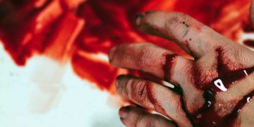 Kanamanın İlaçlarla Durdurulması