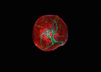 Vimentin İplikçikleri Nedir?