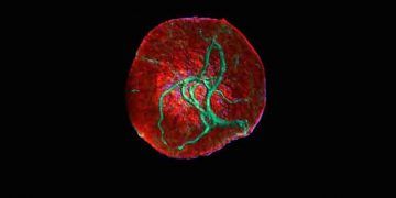 Vimentin İplikçikleri Nedir?