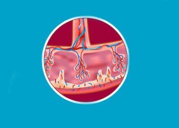 Villöz Plasenta Nedir?