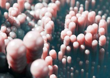 Villus Atrofisi Nedir?