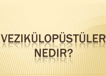 Vezikülopüstüler Nedir?