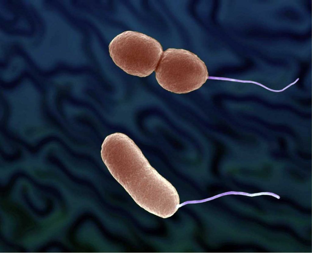 Vibrio Parahaemolyticus Nedir?