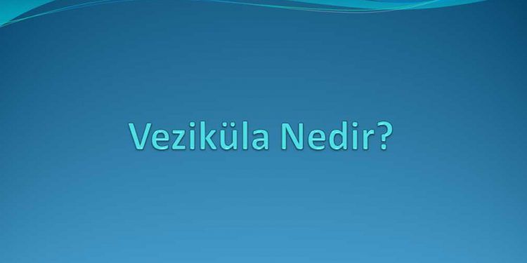 Veziküla Nedir?