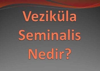 Veziküla Seminalis Nedir?