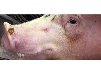 Veziküler Ekzantem Nedir