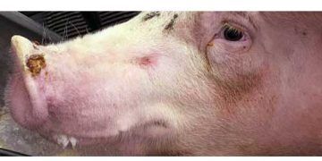 Veziküler Ekzantem Nedir