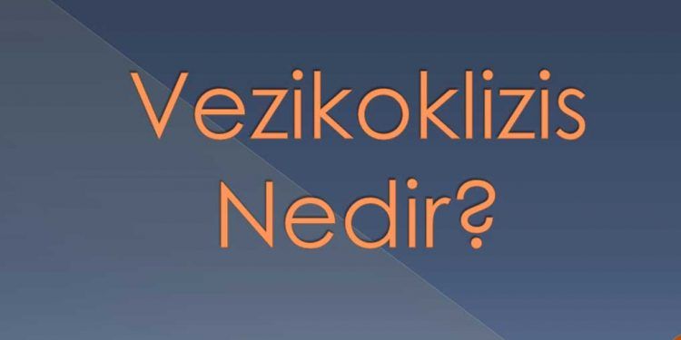 Vezikoklizis Nedir?