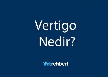 Vertigo Nedir?