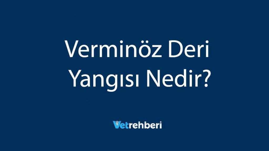 Verminöz Deri Yangısı Nedir?