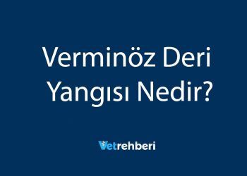 Verminöz Deri Yangısı Nedir?