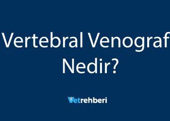 Vertebral Venografi Nedir?