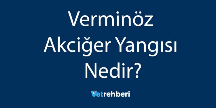 Verminöz Akciğer Yangısı Nedir?