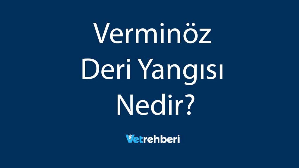 Verminöz Deri Yangısı Nedir?