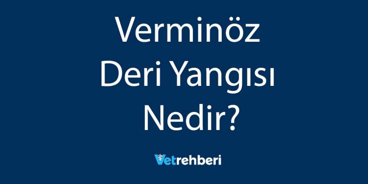 Verminöz Deri Yangısı Nedir?