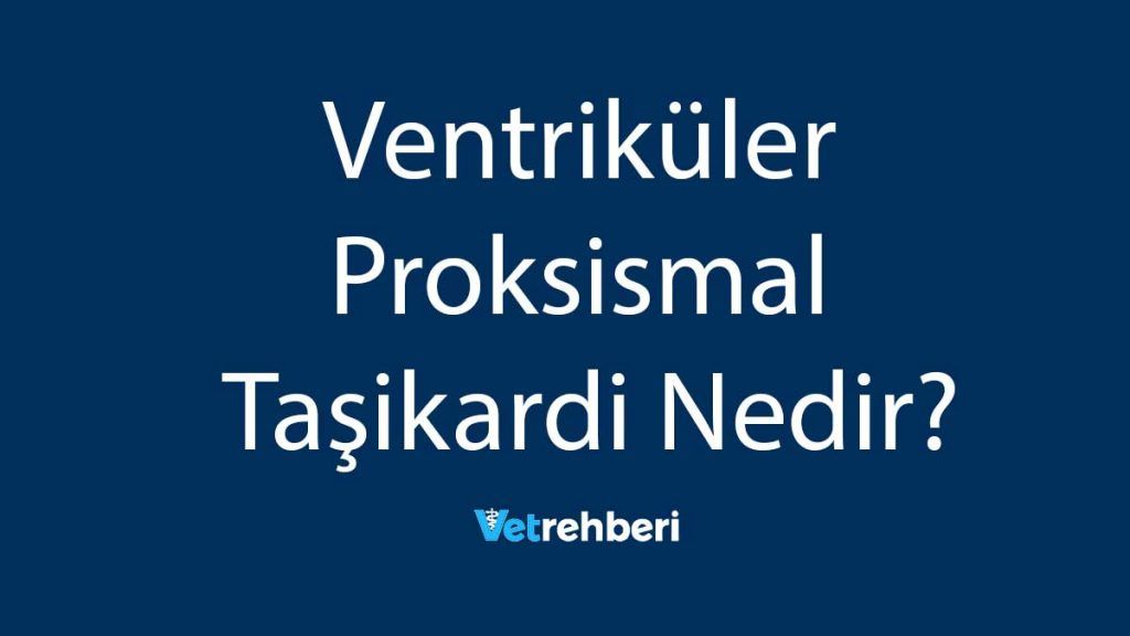 Ventriküler Proksismal Taşikardi Nedir?