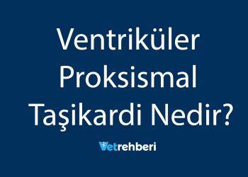 Ventriküler Proksismal Taşikardi Nedir?