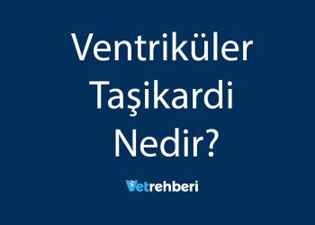 Ventriküler Taşikardi Nedir?