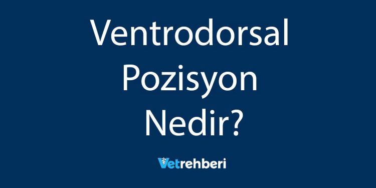 Ventrodorsal Pozisyon Nedir?