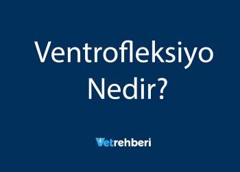 Ventrofleksiyo Nedir?