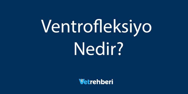 Ventrofleksiyo Nedir?