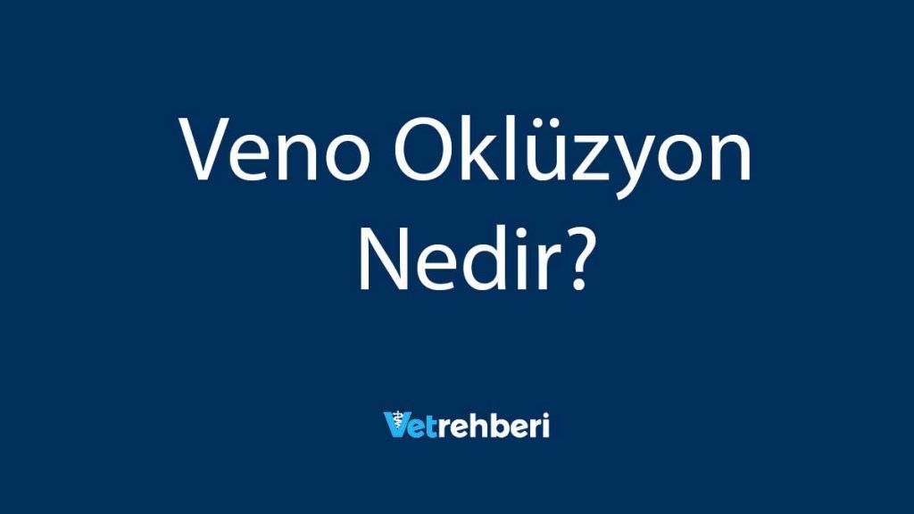 Veno Oklüzyon Nedir?