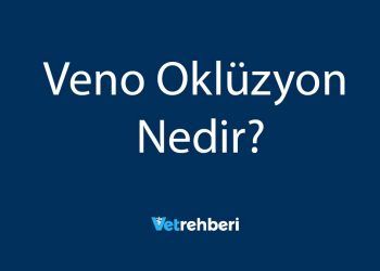 Veno Oklüzyon Nedir?