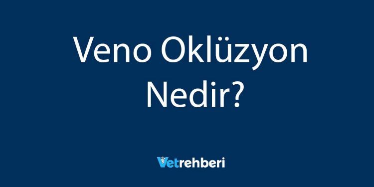 Veno Oklüzyon Nedir?