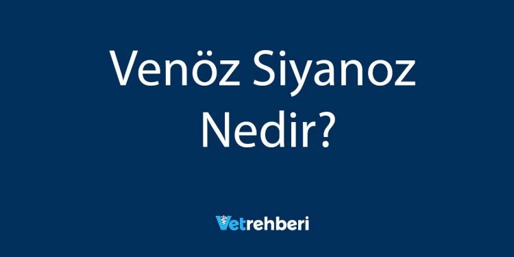 Venöz Siyanoz Nedir?