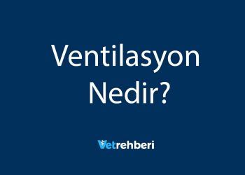 Ventilasyon Nedir?