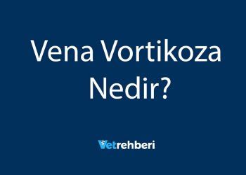 Vena Vortikoza Nedir?