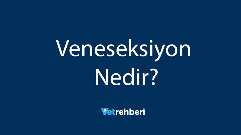 Veneseksiyon Nedir?