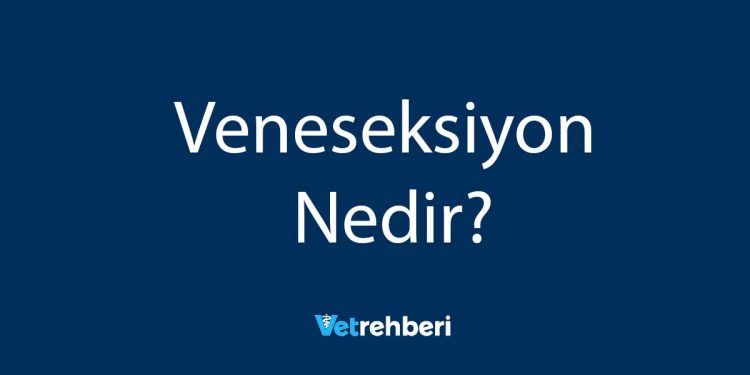 Veneseksiyon Nedir?