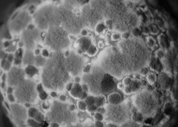 Bazı Zehirlenmeler ve Tedavileri