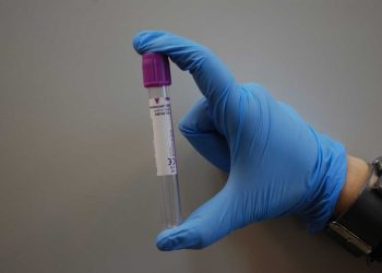 Hormon Analizi İçin Örnek Alma ve Gönderme Yöntemleri