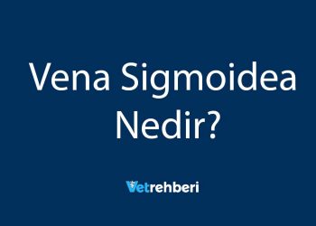 Vena Sigmoidea Nedir?